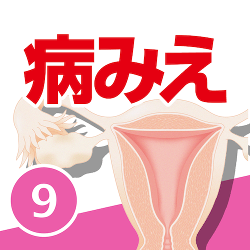 病気がみえるvol.9 婦人科・乳腺外科（第4版)